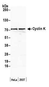 CCNK Antibody - Detection of human Cyclin K by western blot. Samples: Whole cell lysate (50 µg) from HeLa and HEK293T cells prepared using NETN lysis buffer. Antibody: Affinity purified rabbit anti-Cyclin K antibody used for WB at 0.1 µg/ml. Detection: Chemiluminescence with an exposure time of 3 minutes.