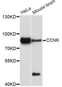 CCNK Antibody - Western blot analysis of extracts of various cell lines, using CCNK antibody at 1:1000 dilution. The secondary antibody used was an HRP Goat Anti-Rabbit IgG (H+L) at 1:10000 dilution. Lysates were loaded 25ug per lane and 3% nonfat dry milk in TBST was used for blocking. An ECL Kit was used for detection and the exposure time was 90s.