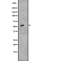 CCNK Antibody - Western blot analysis of CCNK expression in K562 cells lysate. The lane on the left is treated with the antigen-specific peptide.