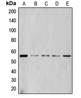 CCNL1 / Cyclin L1 Antibody - Western blot analysis of Cyclin L1 expression in HL60 (A); NIH3T3 (B); Jurkat (C); THP1 (D); K562 (E) whole cell lysates.