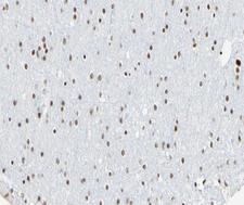 CCNL1 / Cyclin L1 Antibody - 1:100 staining human brain tissue by IHC-P. The tissue was formaldehyde fixed and a heat mediated antigen retrieval step in citrate buffer was performed. The tissue was then blocked and incubated with the antibody for 1.5 hours at 22°C. An HRP conjugated goat anti-rabbit antibody was used as the secondary.