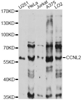 CCNL2 / Cyclin L2 Antibody - Western blot analysis of extracts of various cell lines, using CCNL2 antibody at 1:1000 dilution. The secondary antibody used was an HRP Goat Anti-Rabbit IgG (H+L) at 1:10000 dilution. Lysates were loaded 25ug per lane and 3% nonfat dry milk in TBST was used for blocking. An ECL Kit was used for detection and the exposure time was 90s.