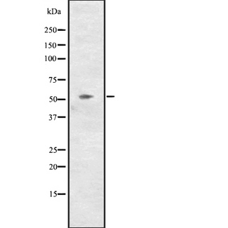 CCNL2 / Cyclin L2 Antibody - Western blot analysis of CCNL2 expression in NCI-H460 cells line lysates. The lane on the left is treated with the antigen-specific peptide.