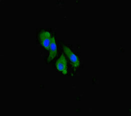 CCNO / UNG2 Antibody - Immunofluorescent analysis of Hela cells diluted at 1:100 and Alexa Fluor 488-congugated AffiniPure Goat Anti-Rabbit IgG(H+L)