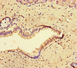 CCNO / UNG2 Antibody - Immunohistochemistry of paraffin-embedded human pancreatic tissue at dilution of 1:100