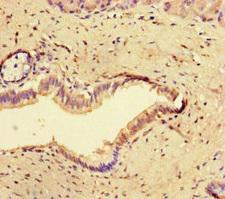 CCNO / UNG2 Antibody - Immunohistochemistry of paraffin-embedded human pancreatic tissue at dilution of 1:100