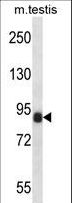 CCNT1 / Cyclin T1 Antibody - CCNT1 Antibody western blot of mouse testis tissue lysates (35 ug/lane). The CCNT1 antibody detected the CCNT1 protein (arrow).