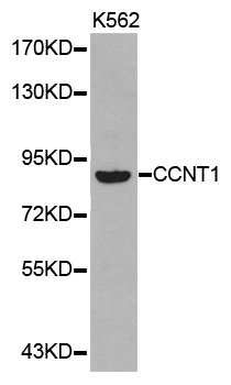 CCNT1 / Cyclin T1 Antibody - Western blot analysis of extracts of K562 cell lines.