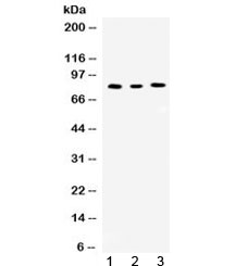 CCNT1 / Cyclin T1 Antibody - Western blot testing of 1) rat kidney, 2) mouse spleen and 3) human Jurkat lysate with Cyclin T1 antibody at 0.5ug/ml. Predicted/observed molecular weight ~81 kDa.