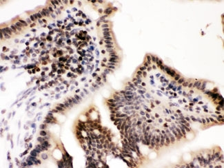 CCNT1 / Cyclin T1 Antibody - IHC testing of FFPE mouse intestine with Cyclin T1 antibody at 1ug/ml. HIER: steam in pH6 citrate buffer and allow to cool prior to staining.