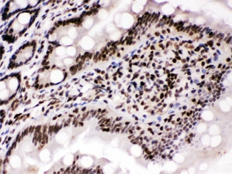CCNT1 / Cyclin T1 Antibody - IHC testing of FFPE rat intestine with Cyclin T1 antibody at 1ug/ml. HIER: steam in pH6 citrate buffer and allow to cool prior to staining.
