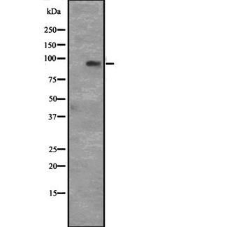 CCNT1 / Cyclin T1 Antibody - Western blot analysis of CCNT1 expression in HeLa cells lysate. The lane on the left is treated with the antigen-specific peptide.