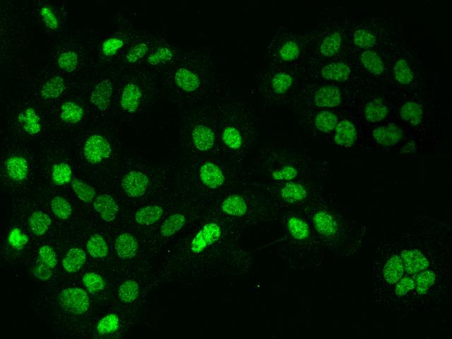 CCNT1 / Cyclin T1 Antibody - Immunofluorescence staining of CCNT1 in A431 cells. Cells were fixed with 4% PFA, permeabilzed with 0.3% Triton X-100 in PBS, blocked with 10% serum, and incubated with rabbit anti-Human CCNT1 polyclonal antibody (dilution ratio 1:200) at 4°C overnight. Then cells were stained with the Alexa Fluor 488-conjugated Goat Anti-rabbit IgG secondary antibody (green). Positive staining was localized to Nucleus.