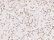 CCNT1 / Cyclin T1 Antibody - Immunochemical staining of human CCNT1 in human adrenal gland with rabbit polyclonal antibody at 1:500 dilution, formalin-fixed paraffin embedded sections.