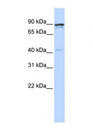 CCNT1 / Cyclin T1 Antibody - CCNT1 / Cyclin T1 antibody Western blot of 721_B Cell lysate. Antibody concentration 1 ug/ml. This image was taken for the unconjugated form of this product. Other forms have not been tested.