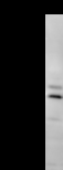 CCNT2 / Cyclin T2 Antibody - Detection of human CCNT2 by Western blot. Samples: Whole cell lysate (50 ug) from HeLa cells. Predicted molecular weight: 81 kDa