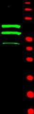 CCNT2 / Cyclin T2 Antibody - Western blot of anti-Cyclin T2 (Rabbit) is shown to detect two major bands (arrowheads) corresponding to human Cyclin T2a and T2b as indicated.