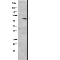 CCNT2 / Cyclin T2 Antibody - Western blot analysis of CCNT2 expression in HepG2 whole cells lysate. The lane on the left is treated with the antigen-specific peptide.