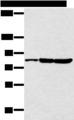 CCNT2 / Cyclin T2 Antibody - Western blot analysis of 293T cell  using CCNT2 Polyclonal Antibody at dilution of 1:250