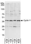 CCNY / Cyclin Y Antibody - Detection of Human Cyclin Y by Western Blot. Samples: Whole cell lysate (50 ug) from HeLa (H), 293T (T), mouse NIH3T3 (3), and MCF7 (M) cells. Antibodies: Affinity purified rabbit anti-Cyclin Y antibody used for WB at 1 ug/ml. Detection: Chemiluminescence with an exposure time of 30 seconds.