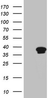 CCNY / Cyclin Y Antibody - HEK293T cells were transfected with the pCMV6-ENTRY control. (Left lane) or pCMV6-ENTRY CCNY. (Right lane) cDNA for 48 hrs and lysed. Equivalent amounts of cell lysates. (5 ug per lane) were separated by SDS-PAGE and immunoblotted with anti-CCNY. (1:2000)