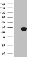 CCNY / Cyclin Y Antibody - HEK293T cells were transfected with the pCMV6-ENTRY control (Left lane) or pCMV6-ENTRY CCNY (Right lane) cDNA for 48 hrs and lysed. Equivalent amounts of cell lysates (5 ug per lane) were separated by SDS-PAGE and immunoblotted with anti-CCNY (1:2000).