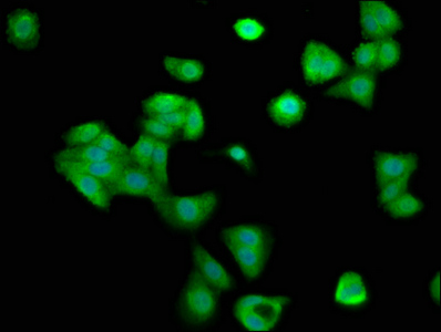 CCNY / Cyclin Y Antibody - Immunofluorescence staining of HepG2 cells at a dilution of 1:200, counter-stained with DAPI. The cells were fixed in 4% formaldehyde, permeabilized using 0.2% Triton X-100 and blocked in 10% normal Goat Serum. The cells were then incubated with the antibody overnight at 4 °C.The secondary antibody was Alexa Fluor 488-congugated AffiniPure Goat Anti-Rabbit IgG (H+L) .