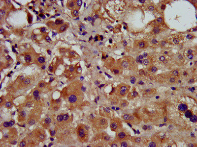 CCNY / Cyclin Y Antibody - Immunohistochemistry image at a dilution of 1:600 and staining in paraffin-embedded human liver tissue performed on a Leica BondTM system. After dewaxing and hydration, antigen retrieval was mediated by high pressure in a citrate buffer (pH 6.0) . Section was blocked with 10% normal goat serum 30min at RT. Then primary antibody (1% BSA) was incubated at 4 °C overnight. The primary is detected by a biotinylated secondary antibody and visualized using an HRP conjugated SP system.