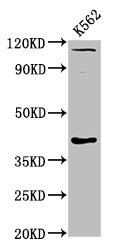 CCNY / Cyclin Y Antibody - Positive Western Blot detected in K562 whole cell lysate. All lanes: CCNY antibody at 6 µg/ml Secondary Goat polyclonal to rabbit IgG at 1/50000 dilution. Predicted band size: 40, 37, 34 KDa. Observed band size: 40 KDa