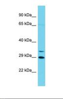 CCNYL1 Antibody - Western blot of Human Jurkat. CCNYL1 antibody dilution 1.0 ug/ml.  This image was taken for the unconjugated form of this product. Other forms have not been tested.