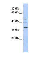 CCNYL1 Antibody - CCNYL1 antibody Western blot of Fetal Brain lysate. This image was taken for the unconjugated form of this product. Other forms have not been tested.