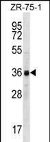 CCNYL2 Antibody - CCNYL2 Antibody (Center) western blot analysis in ZR-75-1 cell line lysates (35ug/lane).This demonstrates the CCNYL2 antibody detected the CCNYL2 protein (arrow).