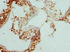 CCP110 Antibody - Immunohistochemistry of paraffin-embedded human testis tissue at dilution 1:100