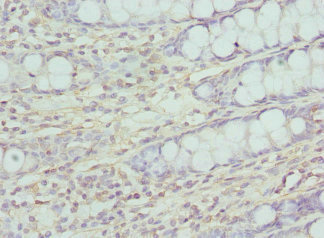 CCP110 Antibody - Immunohistochemistry of paraffin-embedded human rectum tissue at dilution 1:100