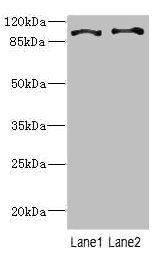 CCP110 Antibody - Western blot All Lanes: CCP110 antibody at 4.6ug/ml Lane 1: Hela whole cell lysate Lane 2: 293T whole cell lysate Goat polyclonal to Rabbit IgG at 1/10000 dilution Predicted band size: 114,112 kDa Observed band size: 113 kDa