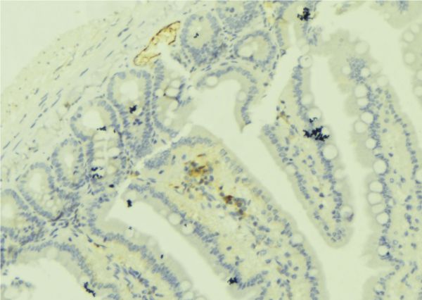 CCP110 Antibody - 1:100 staining mouse colon tissue by IHC-P. The sample was formaldehyde fixed and a heat mediated antigen retrieval step in citrate buffer was performed. The sample was then blocked and incubated with the antibody for 1.5 hours at 22°C. An HRP conjugated goat anti-rabbit antibody was used as the secondary.