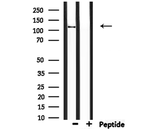 CCP110 Antibody - Western blot analysis of extracts of mouse lung using CEP110 antibody.