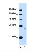 CCPG1 / CRP8 Antibody - Lane A: Marker. Lane B: HepG2 cell lysate. Antibody concentration: 0.25 ug/ml. Gel concentration: 12%.  This image was taken for the unconjugated form of this product. Other forms have not been tested.