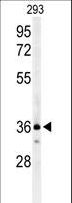 CCR1 Antibody - Western blot of CCR1 Antibody in 293 cell line lysates (35 ug/lane). CCR1 (arrow) was detected using the purified antibody.