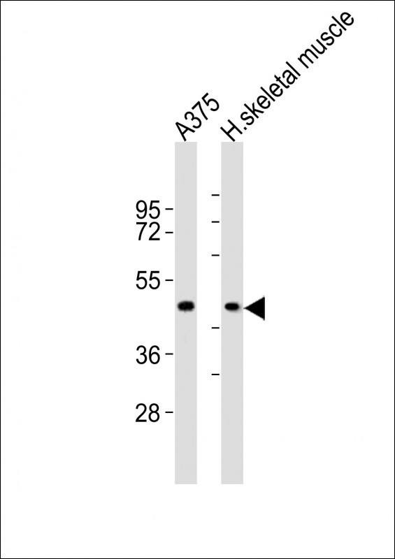 CCR1 Antibody - All lanes : Anti-CCR1 Antibody at 1:2000 dilution Lane 1: A375 whole cell lysates Lane 2: human skeletal muscle lysates Lysates/proteins at 20 ug per lane. Secondary Goat Anti-Rabbit IgG, (H+L), Peroxidase conjugated at 1/10000 dilution Predicted band size : 41 kDa Blocking/Dilution buffer: 5% NFDM/TBST.