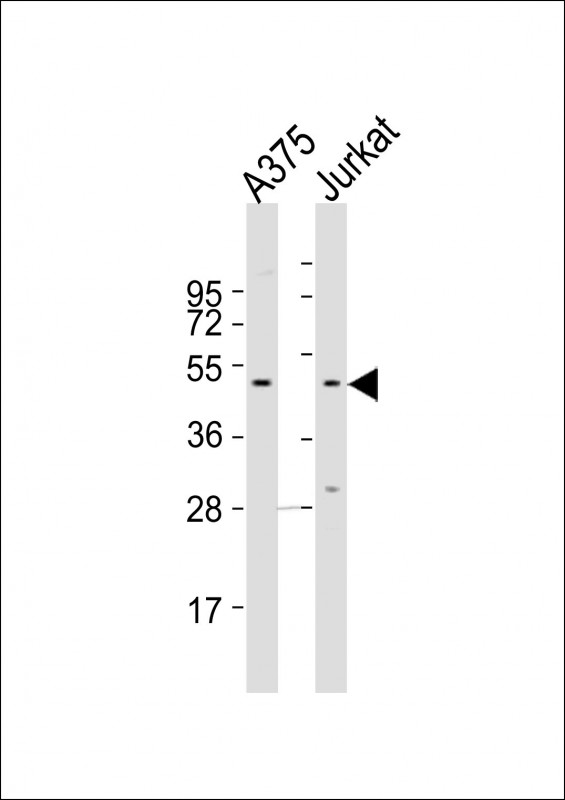 CCR1 Antibody - All lanes : Anti-CCR1 Antibody at 1:2000 dilution Lane 1: A375 whole cell lysates Lane 2: Jurkat whole cell lysates Lysates/proteins at 20 ug per lane. Secondary Goat Anti-Rabbit IgG, (H+L), Peroxidase conjugated at 1/10000 dilution Predicted band size : 41 kDa Blocking/Dilution buffer: 5% NFDM/TBST.