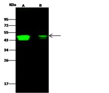 CCR1 Antibody - Anti-CCR1/CD191 rabbit monoclonal antibody at 1:500 dilution. Lane A: HEK293 Whole Cell Lysate. Lane B: 293T Whole Cell Lysate. Lysates/proteins at 30 ug per lane. Secondary: Goat Anti-Rabbit IgG H&L (Dylight800) at 1/10000 dilution. Developed using the Odyssey technique. Performed under reducing conditions. Predicted band size: 43 kDa. Observed band size: 49 kDa.