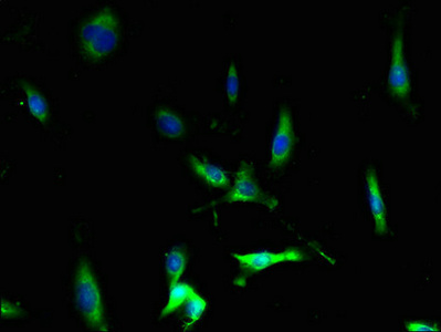 CCR1 Antibody - Immunofluorescent analysis of U251 cells using CCR1 Antibody at dilution of 1:100 and Alexa Fluor 488-congugated AffiniPure Goat Anti-Rabbit IgG(H+L)