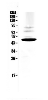 CCR1 Antibody - Western blot analysis of CCR1 using anti-CCR1 antibody. Electrophoresis was performed on a 5-20% SDS-PAGE gel at 70V (Stacking gel) / 90V (Resolving gel) for 2-3 hours. The sample well of each lane was loaded with 50ug of sample under reducing conditions. Lane 1: rat PC-12 whole Cell lysate. After Electrophoresis, proteins were transferred to a Nitrocellulose membrane at 150mA for 50-90 minutes. Blocked the membrane with 5% Non-fat Milk/ TBS for 1.5 hour at RT. The membrane was incubated with rabbit anti-CCR1 antigen affinity purified polyclonal antibody at 0.5 µg/mL overnight at 4°C, then washed with TBS-0.1% Tween 3 times with 5 minutes each and probed with a goat anti-rabbit IgG-HRP secondary antibody at a dilution of 1:10000 for 1.5 hour at RT. The signal is developed using an Enhanced Chemiluminescent detection (ECL) kit with Tanon 5200 system. A specific band was detected for CCR1 at approximately 48KD. The expected band size for CCR1 is at 41KD.