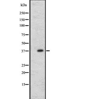 CCR1 Antibody - Western blot analysis of CCR1 expression in A431 whole cells lysate. The lane on the left is treated with the antigen-specific peptide.