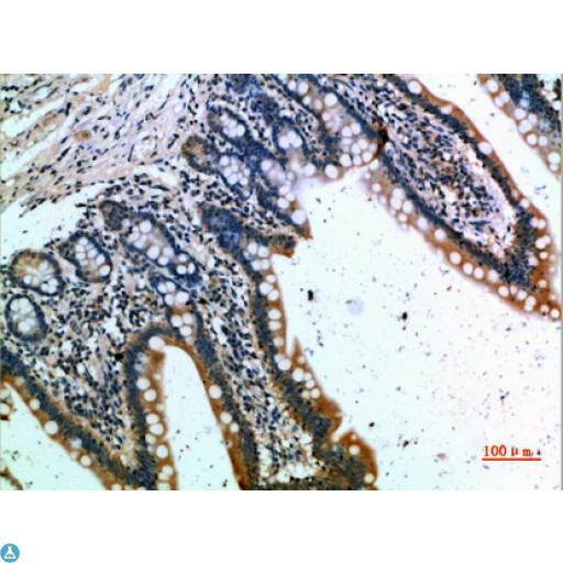 CCR1 Antibody - Immunohistochemical analysis of paraffin-embedded human-small-intestine, antibody was diluted at 1:200.