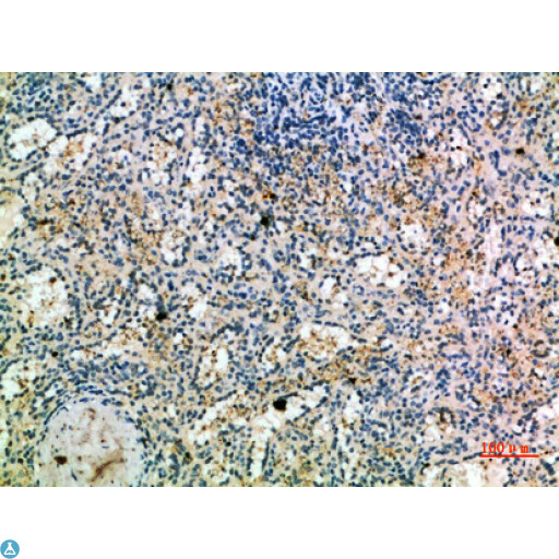 CCR1 Antibody - Immunohistochemical analysis of paraffin-embedded human-spleen, antibody was diluted at 1:200.