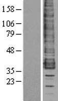 CCR1 Protein - Western validation with an anti-DDK antibody * L: Control HEK293 lysate R: Over-expression lysate