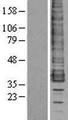 CCR1 Protein - Western validation with an anti-DDK antibody * L: Control HEK293 lysate R: Over-expression lysate
