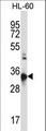 CCR10 / GPR2 Antibody - CCR10 Antibody western blot of HL-60 cell line lysates (35 ug/lane). The CCR10 antibody detected the CCR10 protein (arrow).